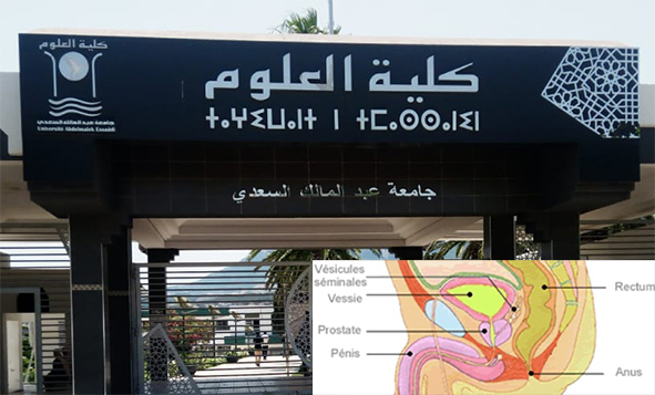 Un remède du cancer de la prostate développé par des chercheurs de l’Université Abdelmalek Essaadi