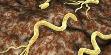 L’infection à l’Helicobacter Pylori et ses complications gastriques