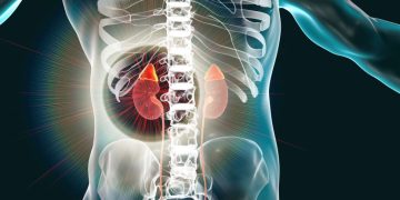 UNE HYPERTENSION ARTERIELLE RESISTANTE A TOUS LES TRAITEMENTS : PROBLEME DES GLANDES SURRENALES ? LE ROLE DU STRESS ?
