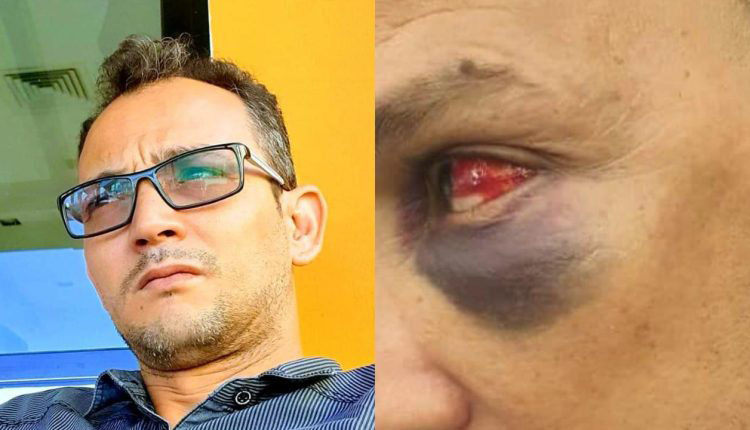 Agression contre un Conseiller Communal